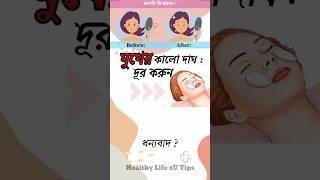 মুখের কলো দাঘ দূর করুন#viral#youtubeshorts#shorts#healthy life 4u tips