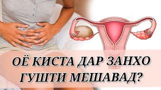 КИСТАИ ТУХМДОНХО./НАМУДХОИ КИСТА ДАР ЗАНХО. #киста #хаётисолим