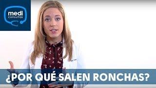 Ronchas ¿por qué aparecen? #MediConsultas