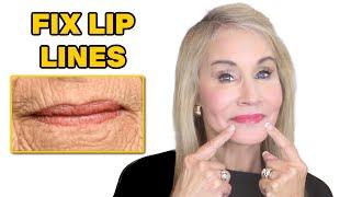 HOW TO FIX LIP LINES | TREATMENT FOR LIP WRINKLES