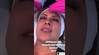 Benefits of MIRApeel microdermabrasion