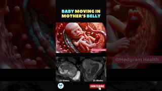 Baby movement   Fetal movement | Baby moving inside mother's womb #shortsfeed #baby #pregnancy