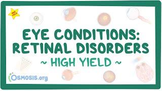 Eye conditions - Retinal disorders: Pathology review