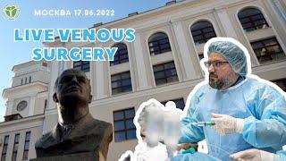 Live Venous Surgery: баллонная ангиопластика ОБВ на базе ТПМ Минздрава (17.06.2022)