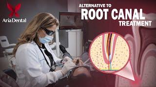 Alternative to Root Canal Treatment | Aria Dental | Maryam Horiyat DDS.