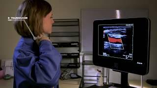 Sonosite Certified Pre-owned Ultrasound Systems