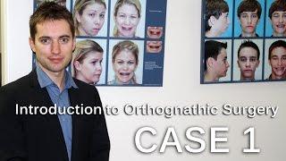 Lecture. Orthognathic Surgery. Introduction and CASE-1. Dr.Alexander V.Antipov, D.D.S.