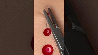 Hemostatic Figure-of-8 Suture 🩸#suturing #goodtoknow #funfact #vet #medicine #surgeon #surgeonlife