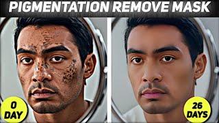 Pigmentation? Treatment by Serum,Home Remedy.Drx Reviews