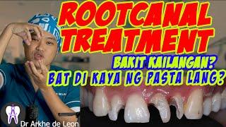 Root Canal Treatment or Therapy Explained #51