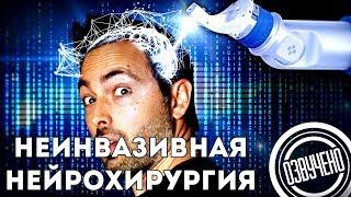 Veritasium: неинвазивная хирургия мозга