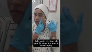 Skin Booster for hydration and instant glow .     #skinbooster #dermatologist #cosmetology