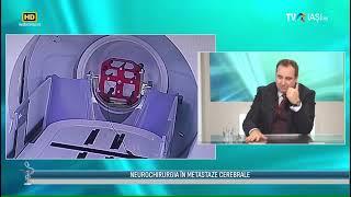 Tableta de sănătate - Secretele neurochirurgiei