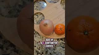 Visualizing Cervical Dilation Using EVERYDAY FOOD ITEMS