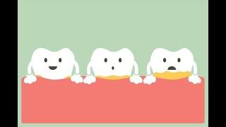Dental plaque its causes, symptoms, treatment and prevention