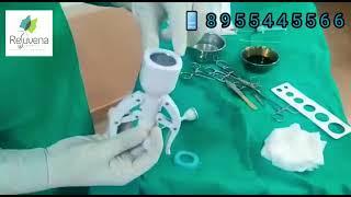 ZSR Circumcision Treatment full video !! Dr. Deepesh Goyal - Rejuvena Cosmo Care