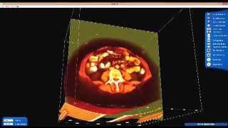 3D CT Scan Technology at A.T. Still University (www.atsu.edu/soma)