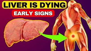 Liver Is Dying! 6 Weird Signs That You Have Liver Damage | HealthQuest