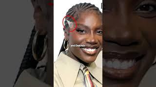 Face Tape Is The NEW FACELIFT?