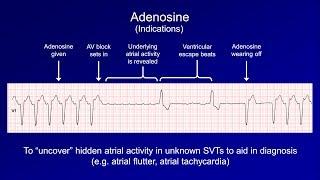 Antiarrhythmics (Lesson 6 - Digoxin, Adenosine, Atropine, Isoproterenol, and Ivabradine)