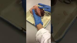 Heart dissection