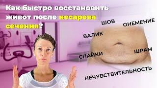 Восстановление живота после кесарева. Что делать? Чего нельзя? Приемы, о которых мало кто знает