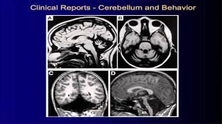 UNM Department of Psychiatry Grand Rounds: Jeremy D. Schmahmann, M.D.