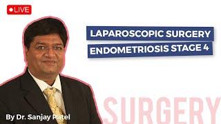 Laparoscopic Surgery Endometriosis Stage 4| Mayflower Women's Hospital