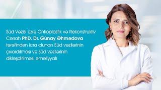 Süd Vəzisi üzrə Onkoplastik və Rekonstruktiv Cərrah PhD.Dr.Günay Əhmədova