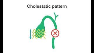 Identifying cholestasis on your liver labs panel