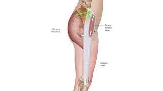 Tensor Fasciae Latae   Muscle Attachment Drawn Illustration Video