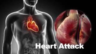 CardioVisual | The easy-to-use heart app