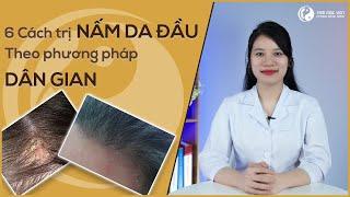 NẤM DA ĐẦU | Bật mí 6 cách điều trị NẤM DA ĐẦU tại nhà HIỆU QUẢ - AN TOÀN nhất | TÂM MỘC VIÊN