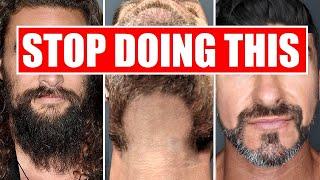 6 WORST Beard FAILS Men Make