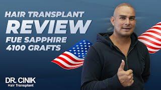 Dr.Cinik Hair Transplant Review | FUE Sapphire | 4100 Grafts