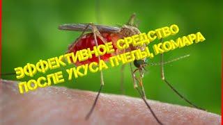 ЭФФЕКТИВНОЕ средство после укусов КОМАРОВ, ПЧЁЛ, МОШЕК