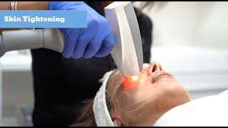 How To Get Tighter Skin | Anti-Aging Must-Have | Skin Tightening | Triniti Laser Clinic & Medi Spa