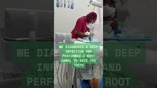 Pain-Free Root Canal Treatment & Dental Crowning in Abuja | Novacare Dental & Maxillofacial Surgery