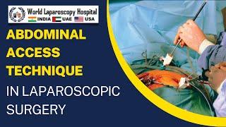 Abdominal Access Technique in Laparoscopic Surgery