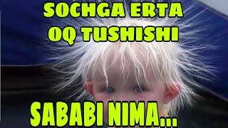 #SOCHGA #ERTA #OQ #TUSHISH #SABABI #NIMA #СОЧГА #ЕРТА #ОК #ТУШИШ #САБАБЛАРИ #НИМА