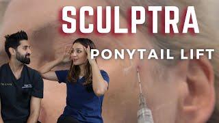 SCULPTRA ponytail lift | non surgical fox eye | liquid face lift