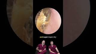 Ear Wax Rolled in Dust?!