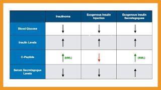 Insulinoma vs. Factitious Hypoglycemia