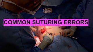 Common Suturing Errors & How to Avoid Them: Tips from a Plastic Surgeon