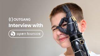 Using Blender and 3d Printing to Make Bionic Arms | Open Bionics Interview