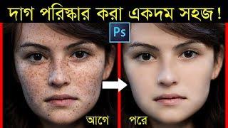 How to Quickly Smooth Skin and Remove Dark Spots, Blemishes & Scars (Easily): Photoshop Tutorial