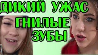 ГНИЛЫЕ ЗУБЫ САВКИНОЙ! НОВОСТИ 27.08.2019