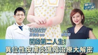 【醫探究竟】開啟第二人生！異位性皮膚炎進階治療大解密│梁惠雯 ft. 王敬瑜 臺大醫院雲林分院小兒部主治醫師