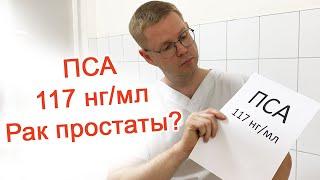 ПСА 117 нг/мл – Рак простаты? / Доктор Черепанов