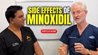 Side Effects of Minoxidil